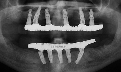 Smile Treatment