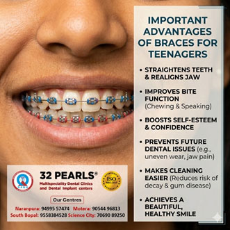 Braces Treatment Image