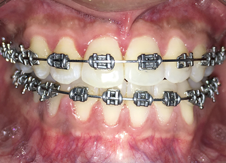 How Much Do Braces Cost?, Orthodontic Services