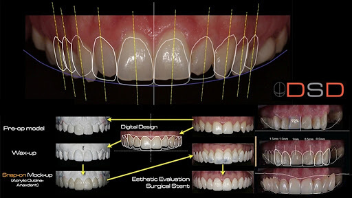 Smile Treatment