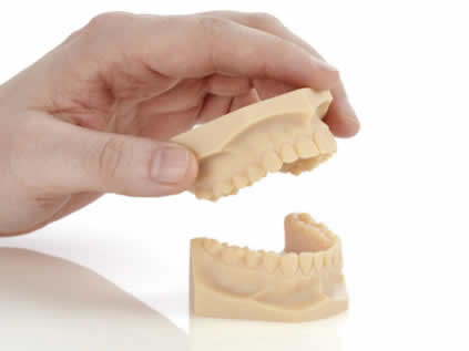 Braces Treatment Image