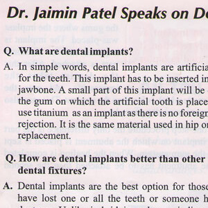 Fixed (Ceramic) Teeth Image