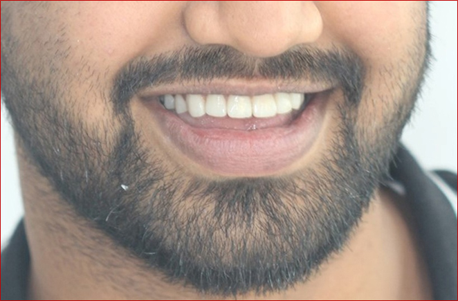 Smile