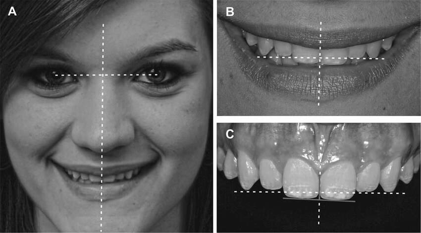 Smile Treatment