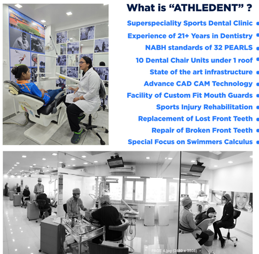 Best Sports Dentist Ahmedabad