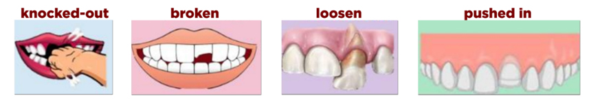 Best Sports Mouth Guard in Ahmedabad
