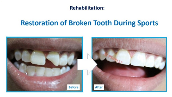 Sports Dentistry Center in Ahmedabad