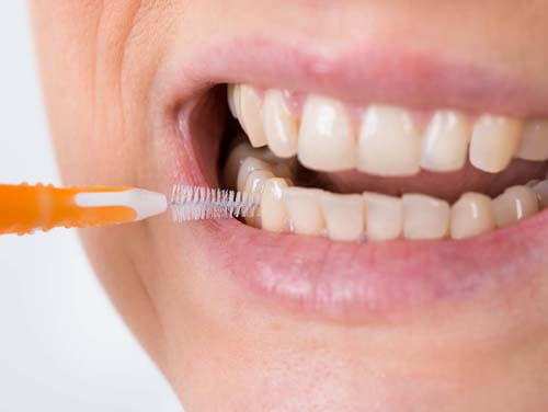 Teeth Cleaning Cost in India