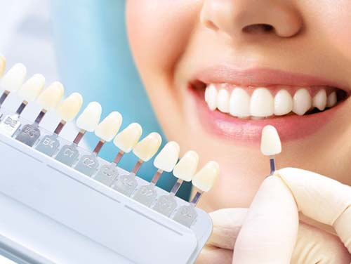 Teeth Whitening in India